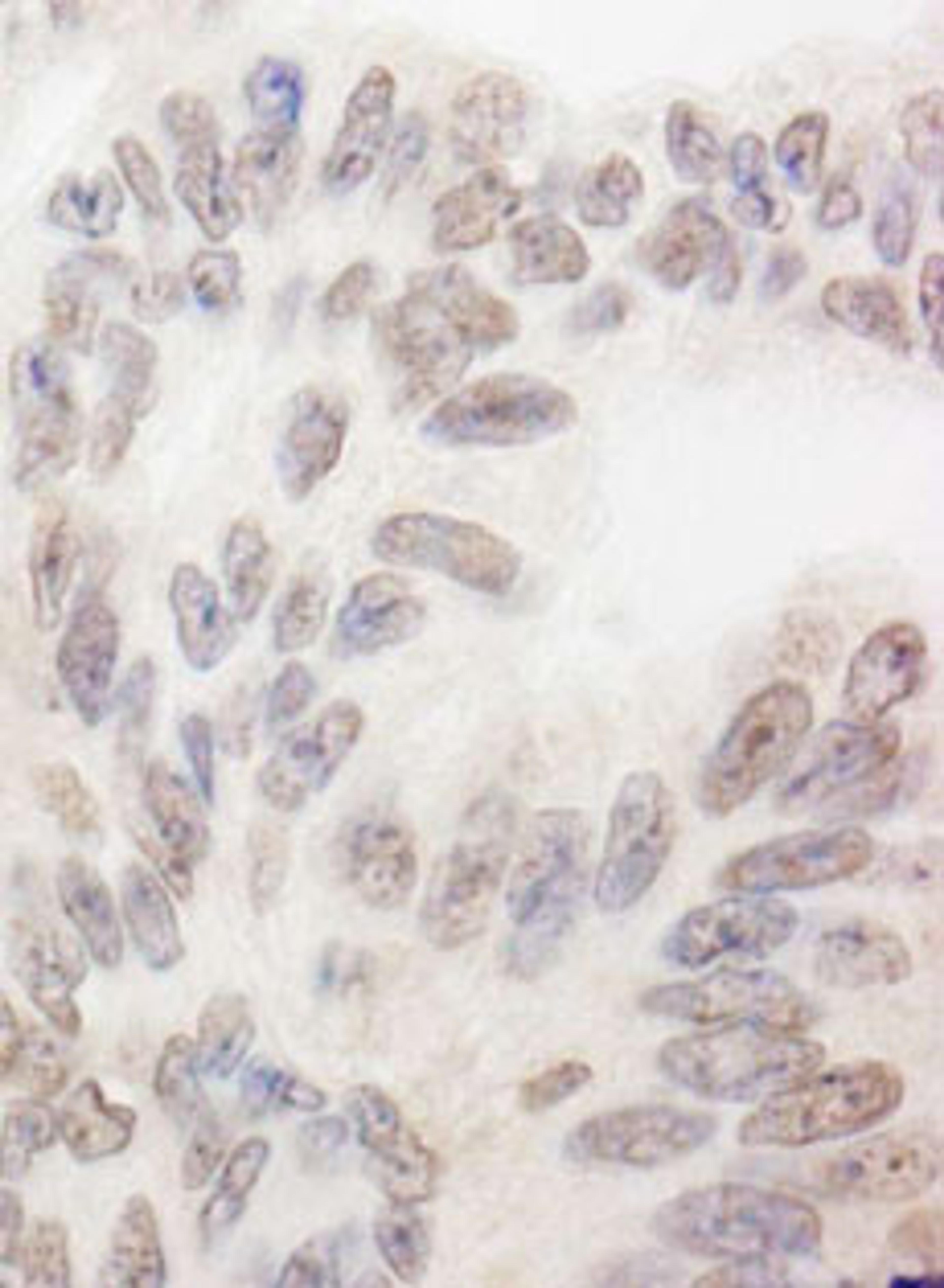 Detection of human RBM12 by immunohistochemistry.