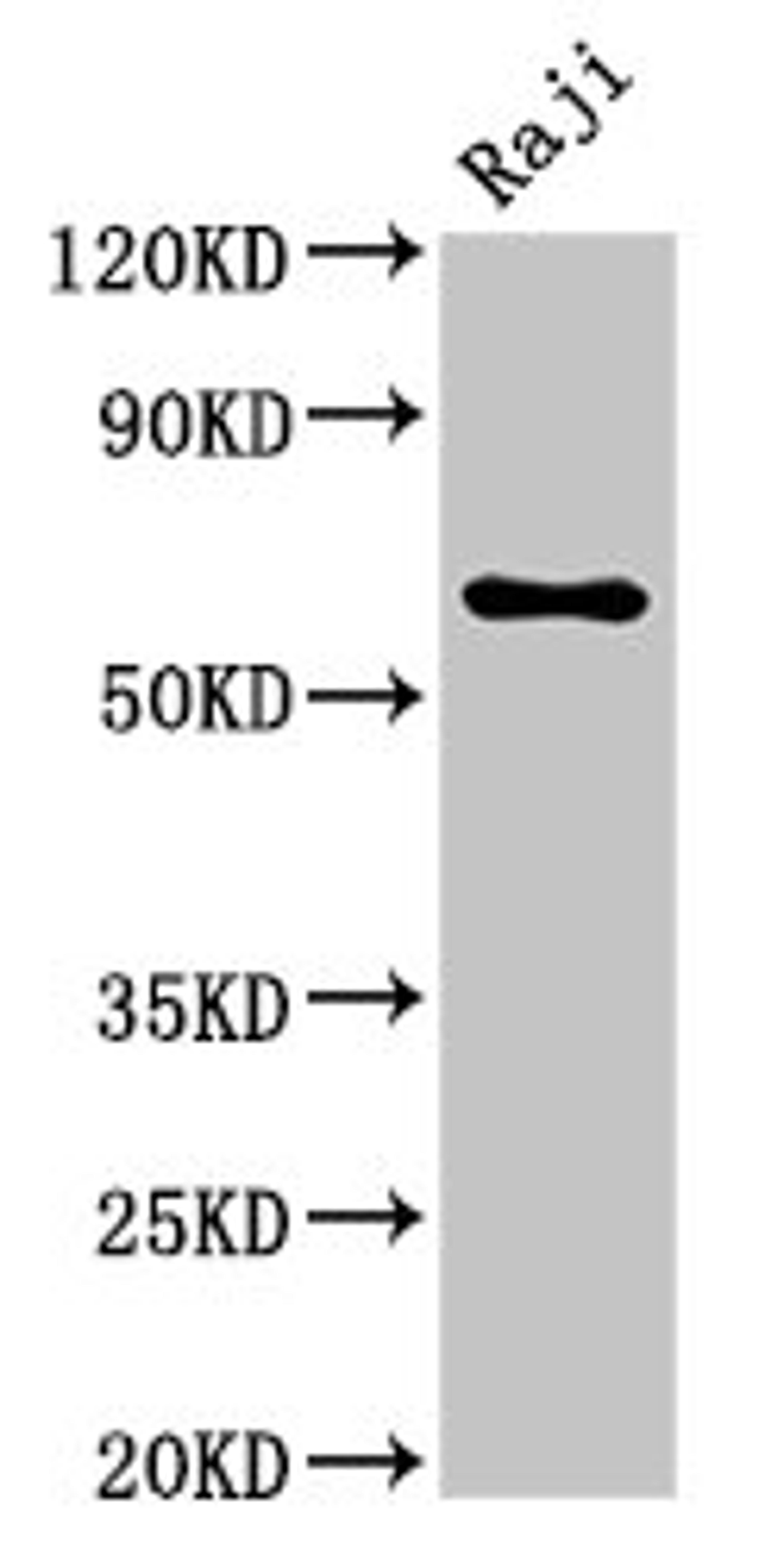 Western Blot. Positive WB detected in: Raji whole cell lysate. All lanes: MSN antibody at 5.7ug/ml. Secondary. Goat polyclonal to rabbit IgG at 1/50000 dilution. Predicted band size: 68 kDa. Observed band size: 68 kDa. 