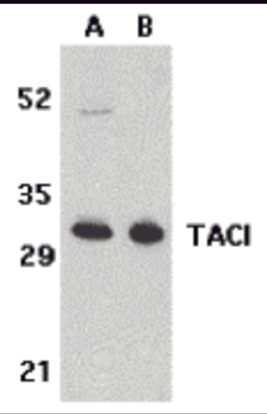 Western blot analysis of TACI in K562 (A) and U937 (B) cell lysates with TACI antibody at 5 μg/mL.