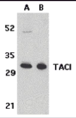 Western blot analysis of TACI in K562 (A) and U937 (B) cell lysates with TACI antibody at 5 μg/mL.