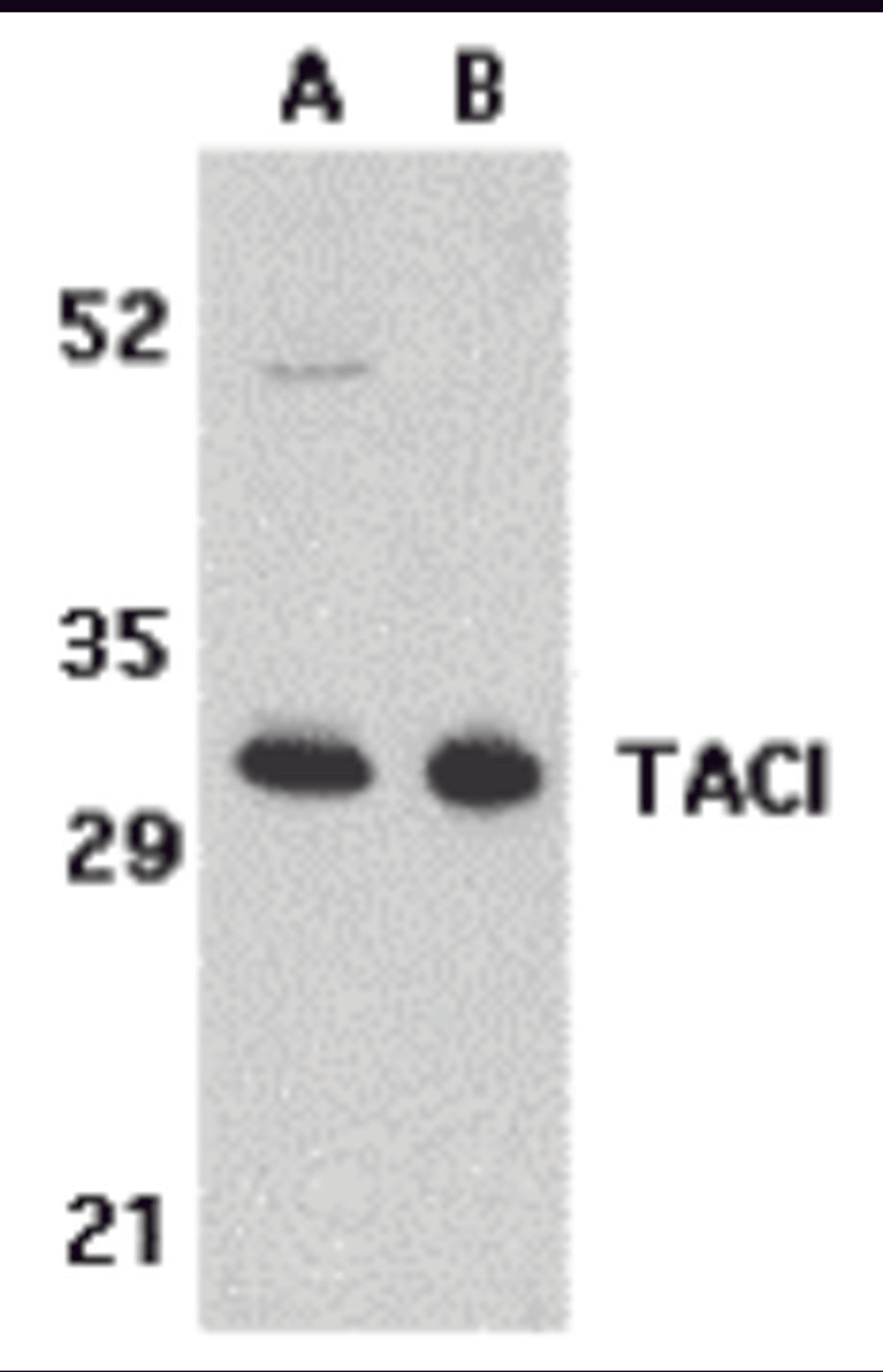 Western blot analysis of TACI in K562 (A) and U937 (B) cell lysates with TACI antibody at 5 μg/mL.