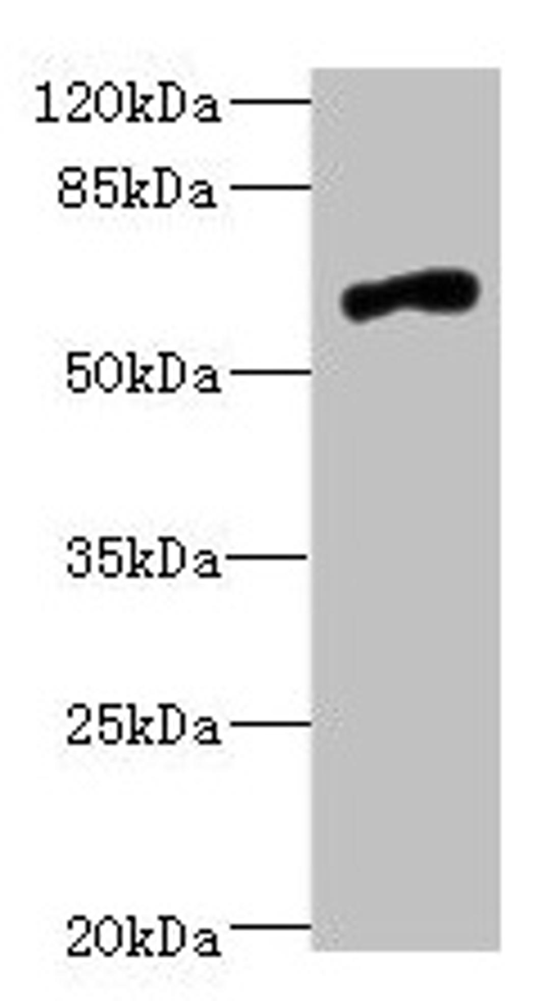 Western blot. All lanes: NRXN3 antibody at 2.03µg/ml + 293T whole cell lysate. Secondary. Goat polyclonal to rabbit IgG at 1/10000 dilution. Predicted band size: 181, 118, 154, 70, 48, 44, 51 kDa. Observed band size: 70 kDa