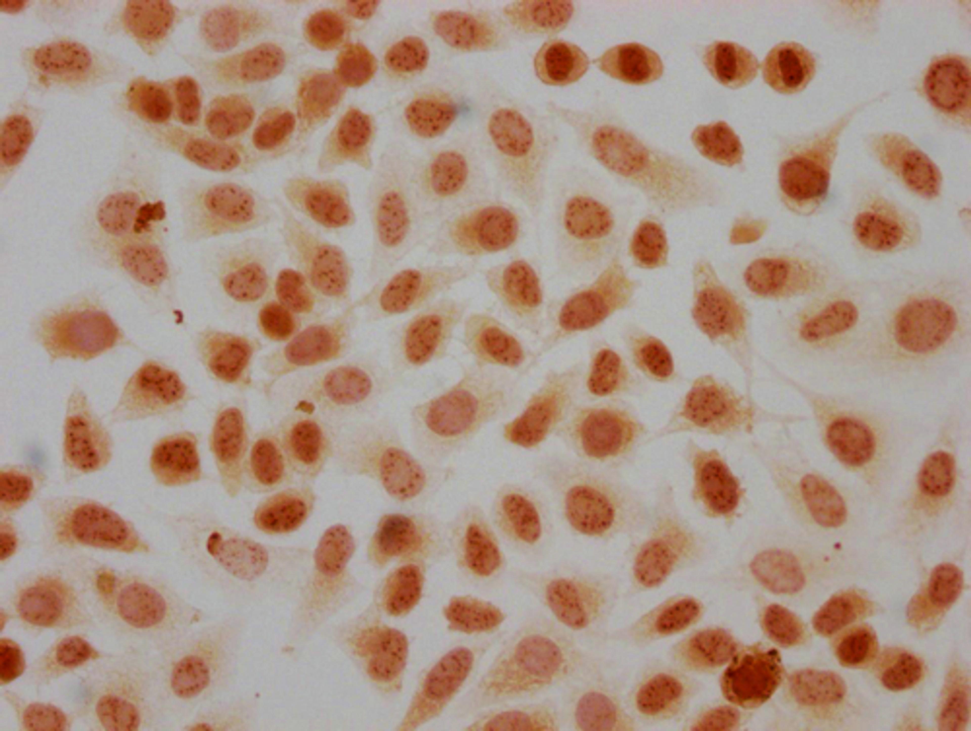 Immunocytochemistry analysis of CSB-PA010418PA41phHU diluted at 1:20 and staining in Hela cells(treated with 50nM Calyculin A for 30min) performed on a Leica BondTM system. The cells were fixed in 4% formaldehyde, permeabilized using 0.2% Triton X-100 and blocked with 10% normal goat serum 30min at RT. Then primary antibody (1% BSA) was incubated at 4°C overnight. The primary is detected by a biotinylated secondary antibody and visualized using an HRP conjugated SP system.