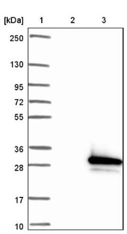 Western Blot: NME5 Antibody [NBP1-92188] - Lane 1: Marker [kDa] 250, 130, 95, 72, 55, 36, 28, 17, 10<br/>Lane 2: Negative control (vector only transfected HEK293T lysate)<br/>Lane 3: Over-expression lysate (Co-expressed with a C-terminal myc-DDK tag (~3.1 kDa) in mammalian HEK293T cells, LY418593)