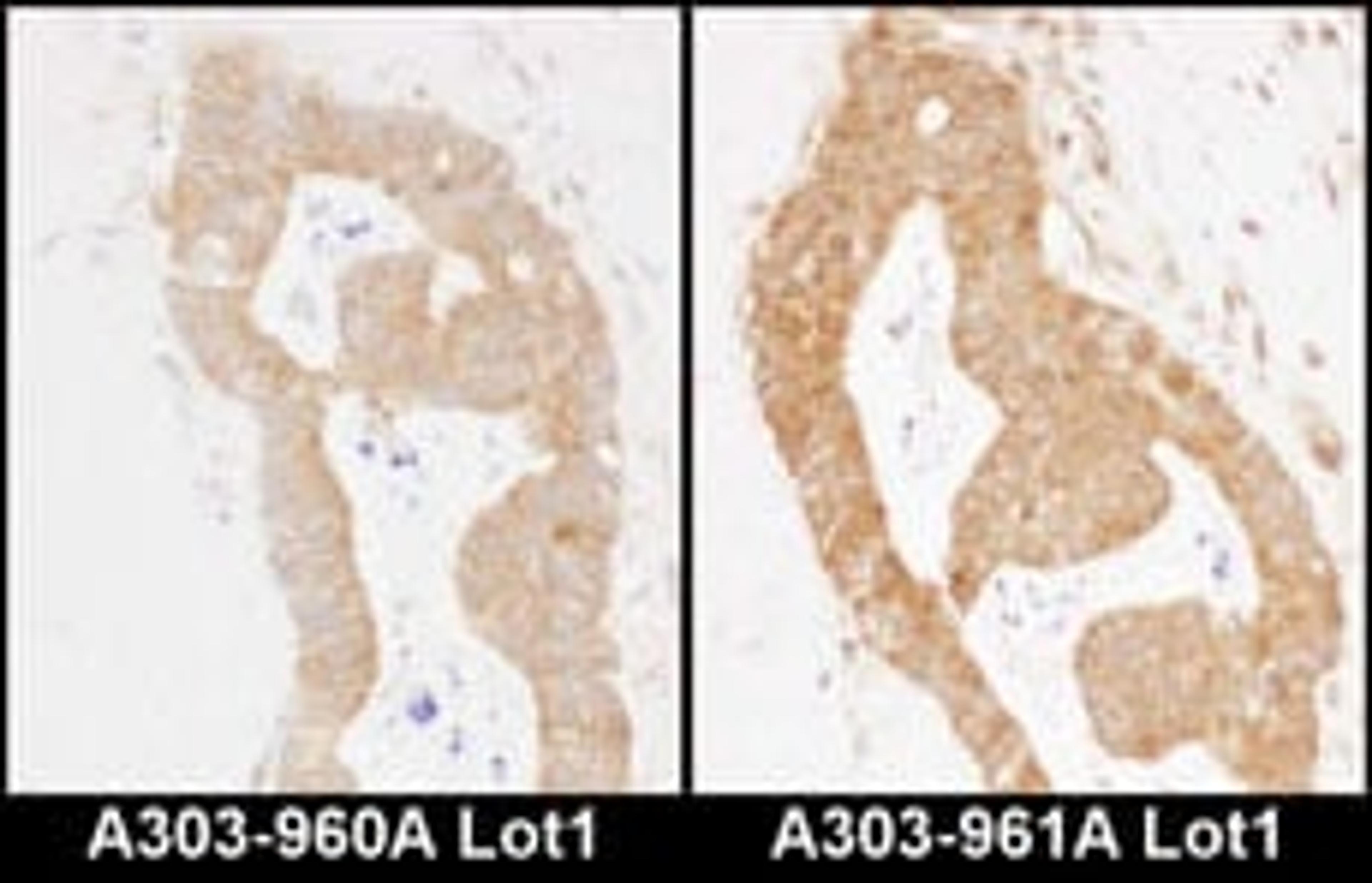 Detection of human MARS by immunohistochemistry.