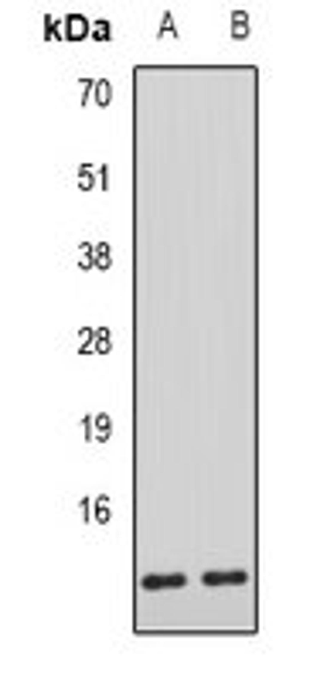 Western blot analysis of mouse liver (Lane1), rat liver (Lane2) whole cell lysates using AHSP antibody