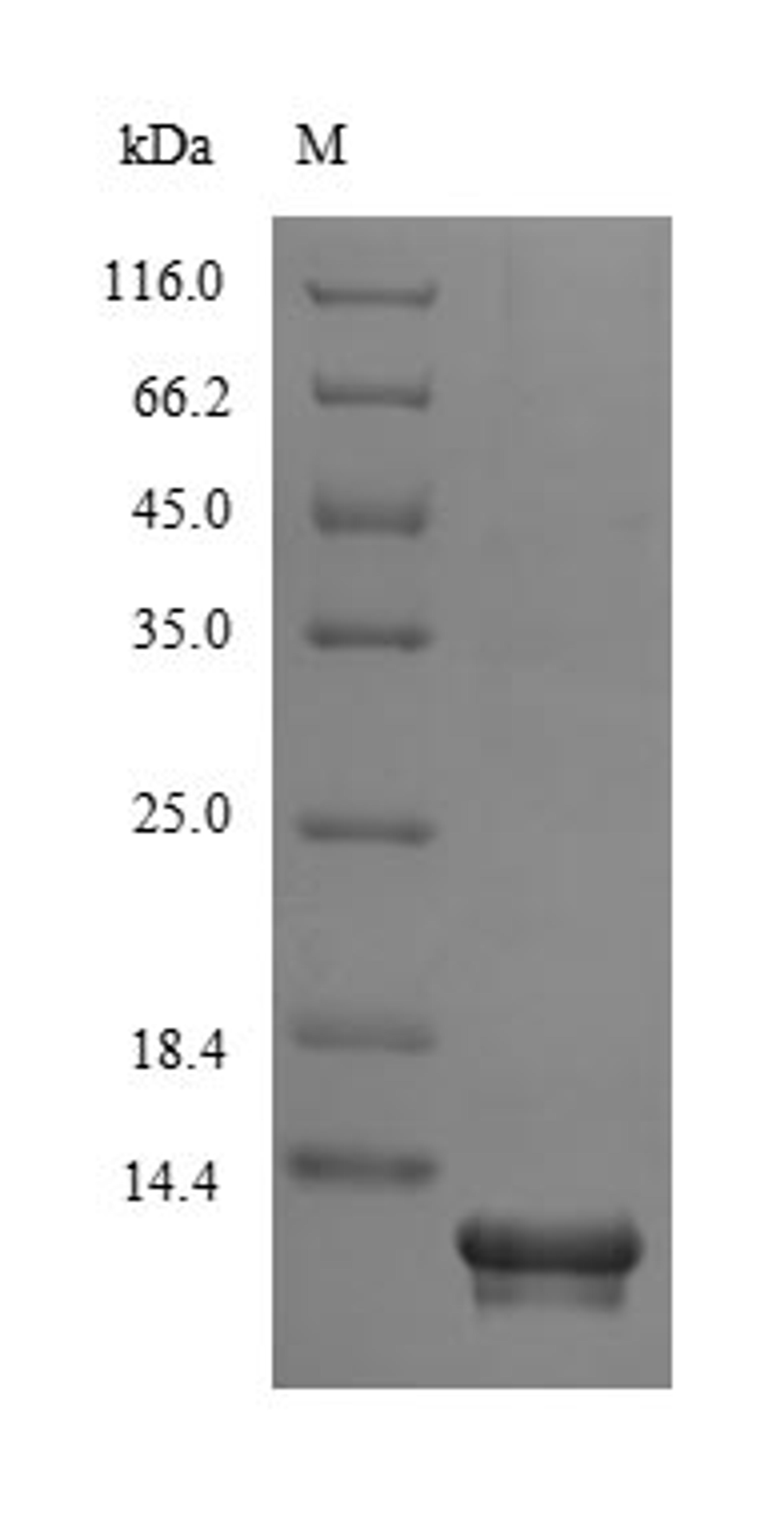 (Tris-Glycine gel) Discontinuous SDS-PAGE (reduced) with 5% enrichment gel and 15% separation gel.
