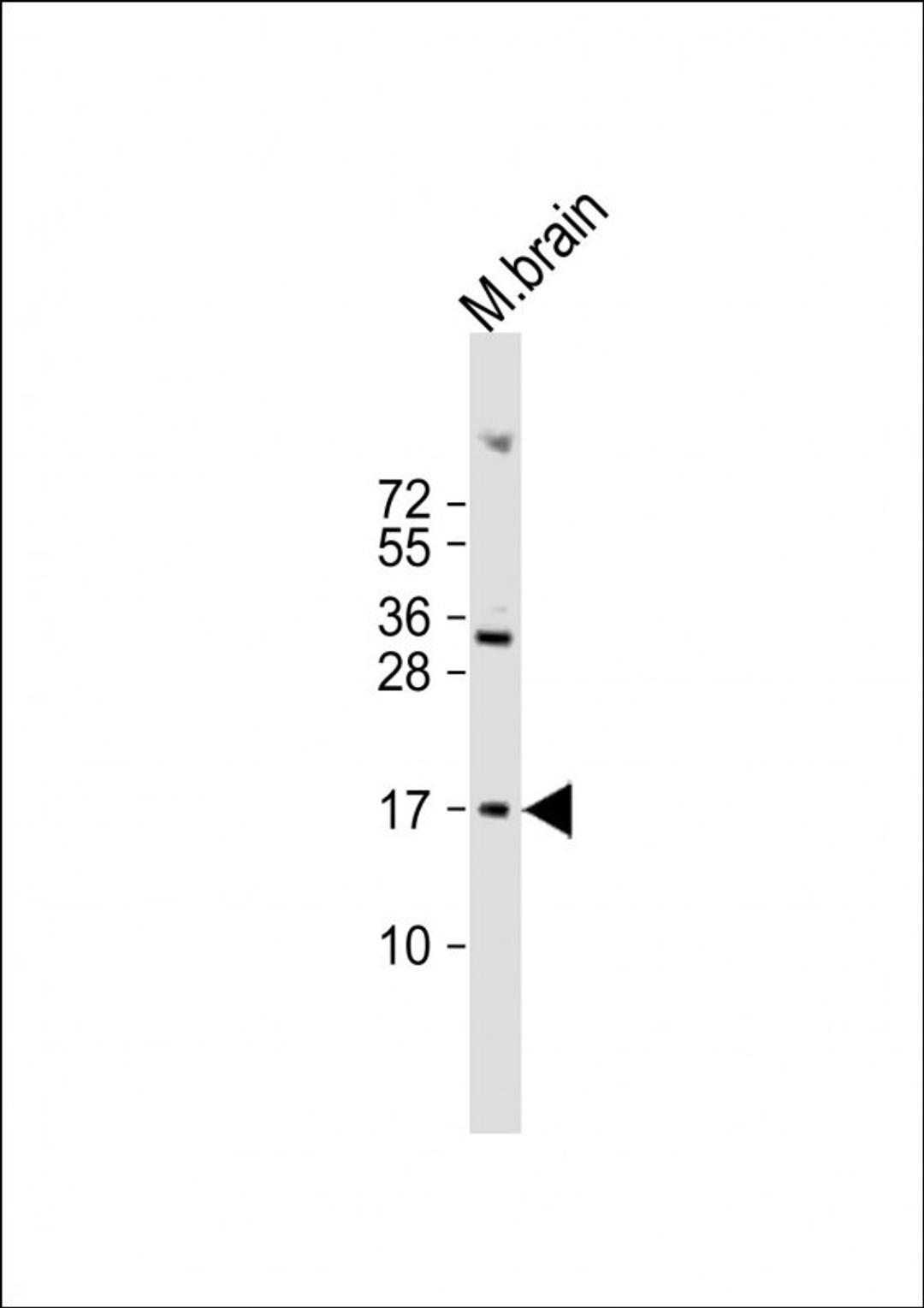 Western Blot at 1:2000 dilution + mouse brain lysate Lysates/proteins at 20 ug per lane.