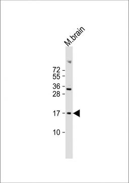 Western Blot at 1:2000 dilution + mouse brain lysate Lysates/proteins at 20 ug per lane.