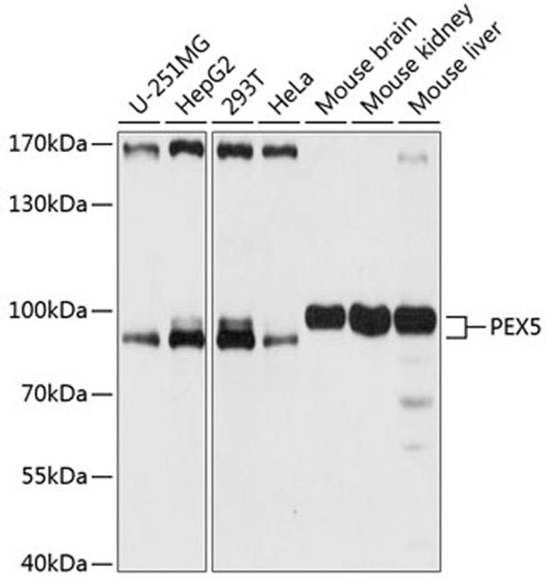 Western blot - PEX5 antibody (A12493)