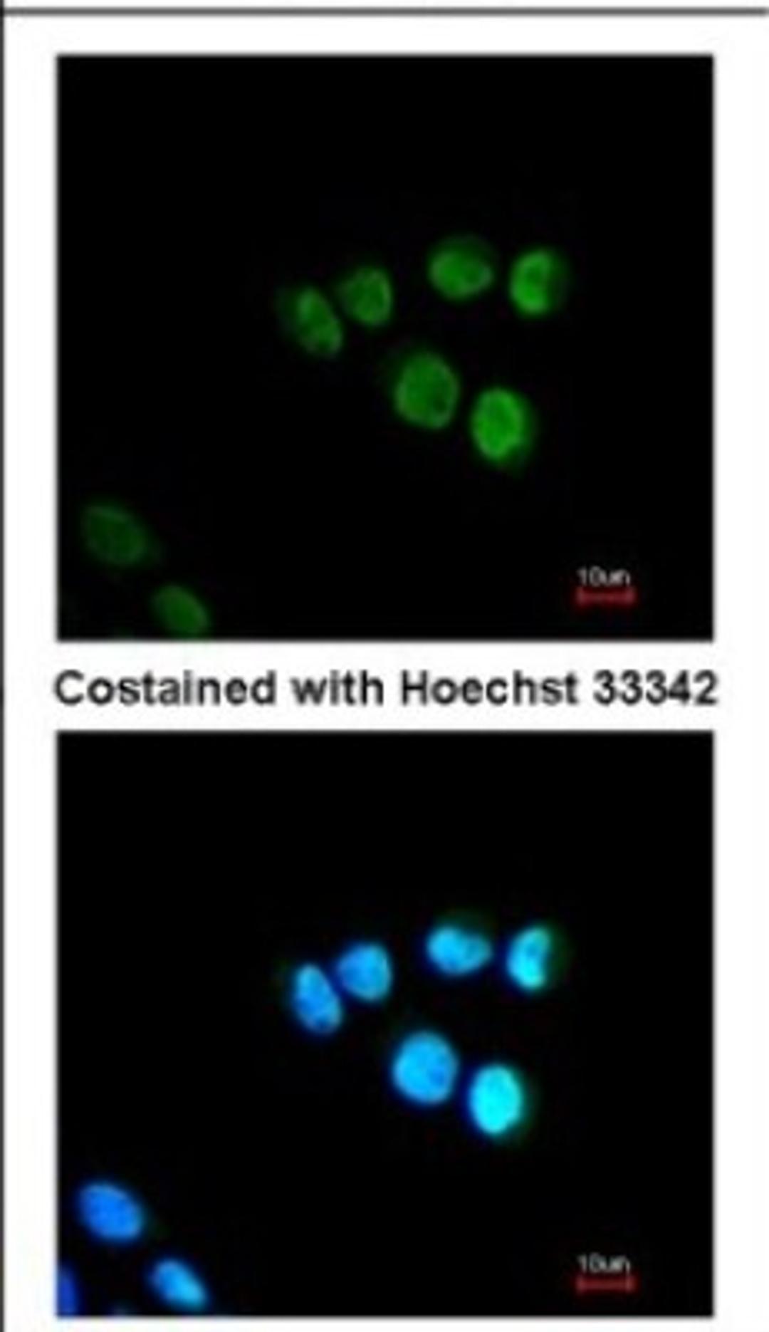 Immunocytochemistry/Immunofluorescence: MED17 Antibody [NBP2-17256] - Immunofluorescence analysis of paraformaldehyde-fixed A431, using antibody at 1:200 dilution.