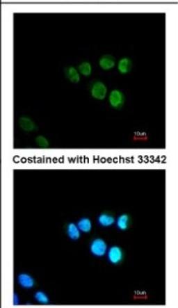 Immunocytochemistry/Immunofluorescence: MED17 Antibody [NBP2-17256] - Immunofluorescence analysis of paraformaldehyde-fixed A431, using antibody at 1:200 dilution.