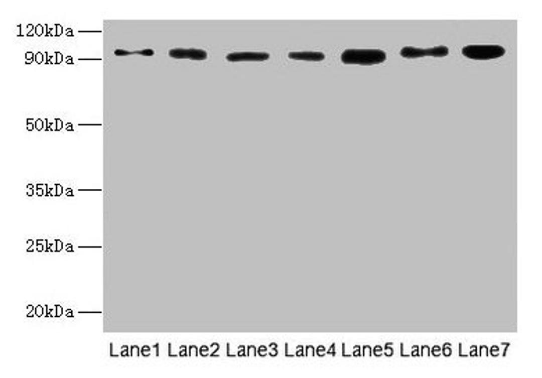 Western blot. All lanes: USP5 antibody at 10µg/ml. Lane 1: Mouse brain tissue. Lane 2: A549 whole cell lysate. Lane 3: MCF-7 whole cell lysate. Lane 4: A375 whole cell lysate. Lane 5: U251 whole cell lysate. Secondary. Goat polyclonal to rabbit IgG at 1/10000 dilution. Predicted band size: 96, 94 kDa. Observed band size: 96 kDa