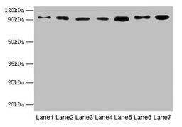 Western blot. All lanes: USP5 antibody at 10µg/ml. Lane 1: Mouse brain tissue. Lane 2: A549 whole cell lysate. Lane 3: MCF-7 whole cell lysate. Lane 4: A375 whole cell lysate. Lane 5: U251 whole cell lysate. Secondary. Goat polyclonal to rabbit IgG at 1/10000 dilution. Predicted band size: 96, 94 kDa. Observed band size: 96 kDa
