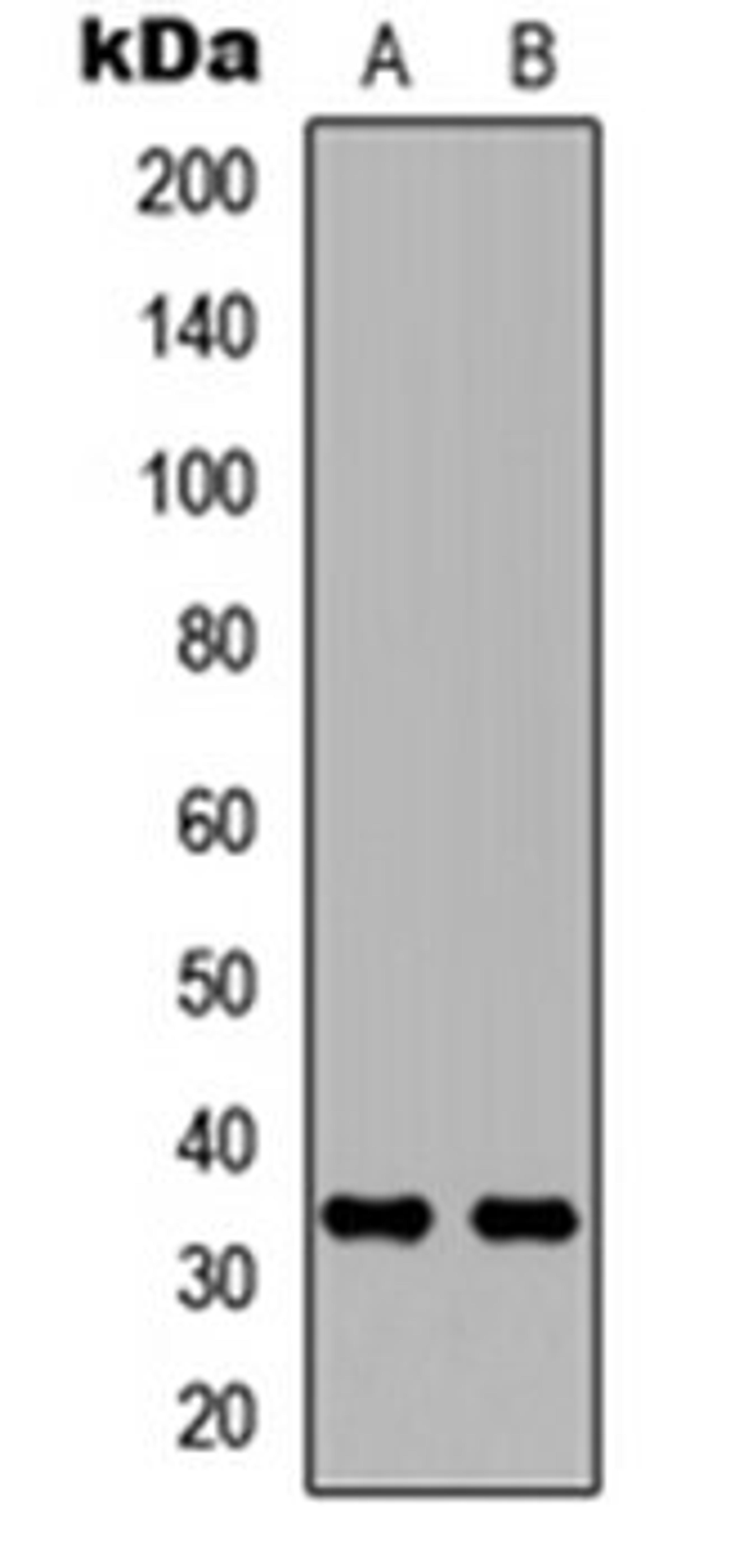 Western blot analysis of MCF7 (Lane 1), NS-1 (Lane 2) whole cell lysates using Carbonic Anhydrase 8 antibody