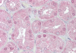 Immunohistochemical staining of Human Kidney using FOXD1 antibody