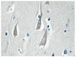 Immunohistochemistry-Paraffin: CaMKII alpha/delta [p Thr286] Antibody [NBP1-51462] - Human brain tissue.