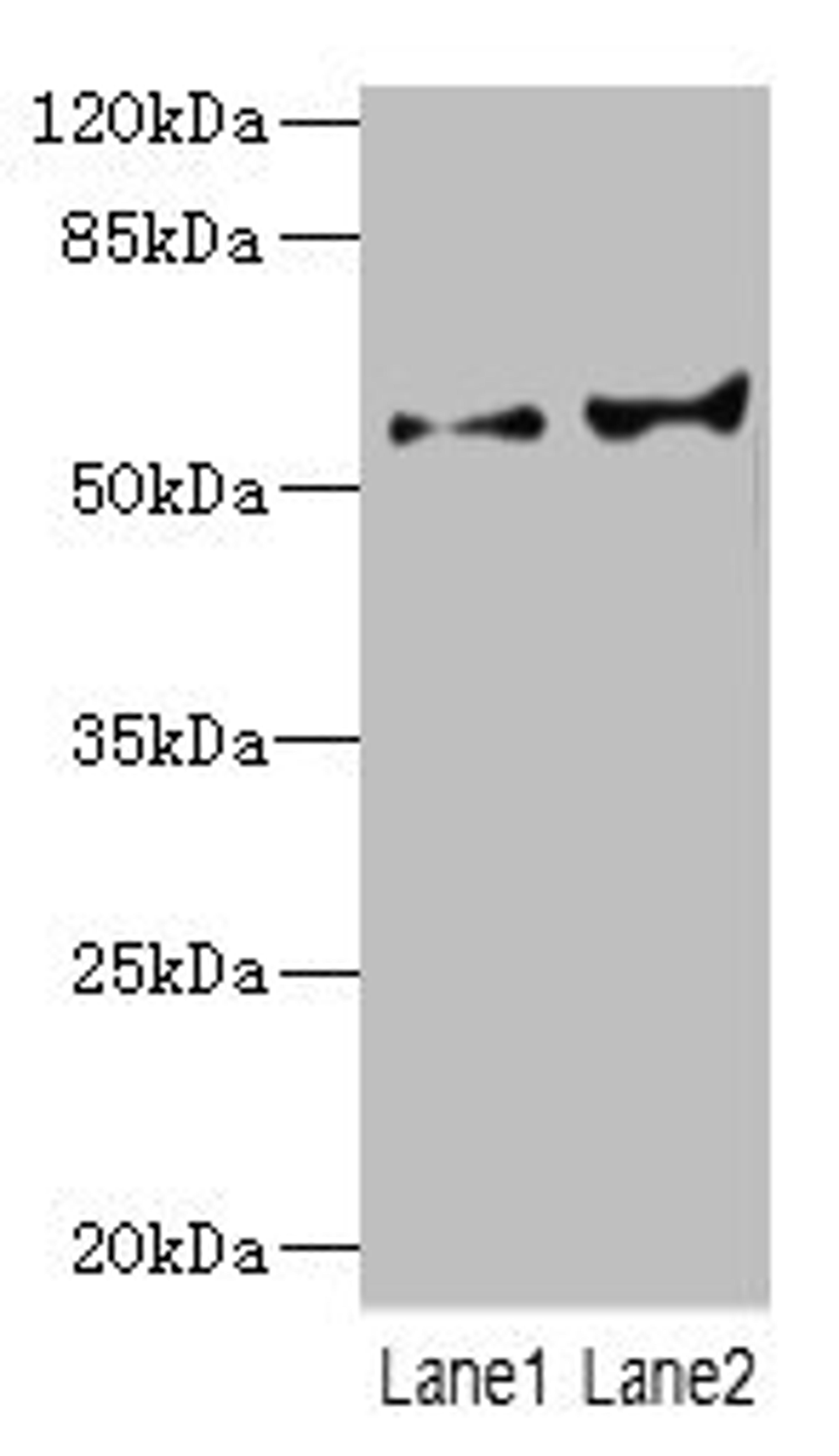 Western blot. All lanes: CYP2C18 antibody at 5.98ug/ml. Lane 1: HL60 whole cell lysate. Lane 2: 293T whole cell lysate. Secondary. Goat polyclonal to rabbit IgG at 1/10000 dilution. Predicted band size: 56, 49 kDa. Observed band size: 56 kDa. 