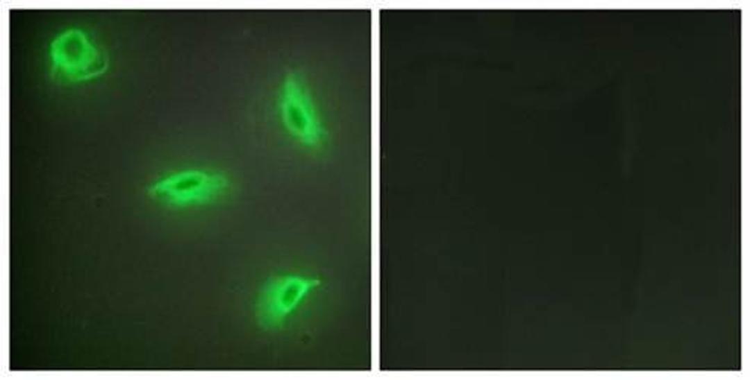 Confocal immunofluorescence analysis of HeLa cells using TNF14 antibody