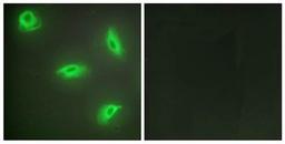 Confocal immunofluorescence analysis of HeLa cells using TNF14 antibody