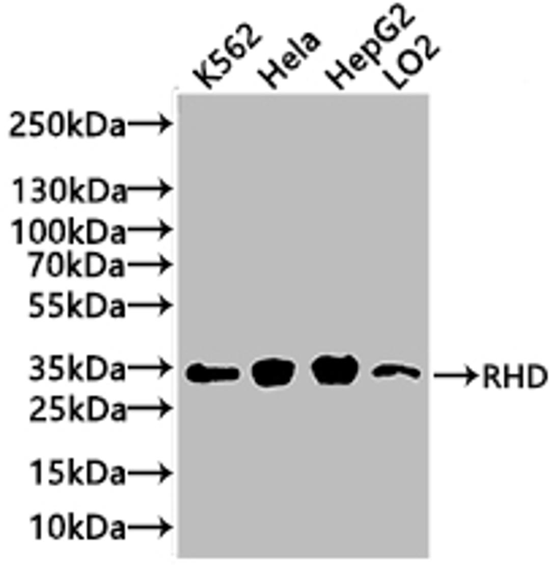 Western Blot. Positive WB detected in: Mouse liver tissue. All lanes: RHD antibody at 3ug/ml. Secondary. Goat polyclonal to rabbit IgG at 1/50000 dilution. Predicted band size: 46, 35, 54, 44, 42 kDa. Observed band size: 46 kDa. 