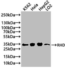 Western Blot. Positive WB detected in: Mouse liver tissue. All lanes: RHD antibody at 3ug/ml. Secondary. Goat polyclonal to rabbit IgG at 1/50000 dilution. Predicted band size: 46, 35, 54, 44, 42 kDa. Observed band size: 46 kDa. 