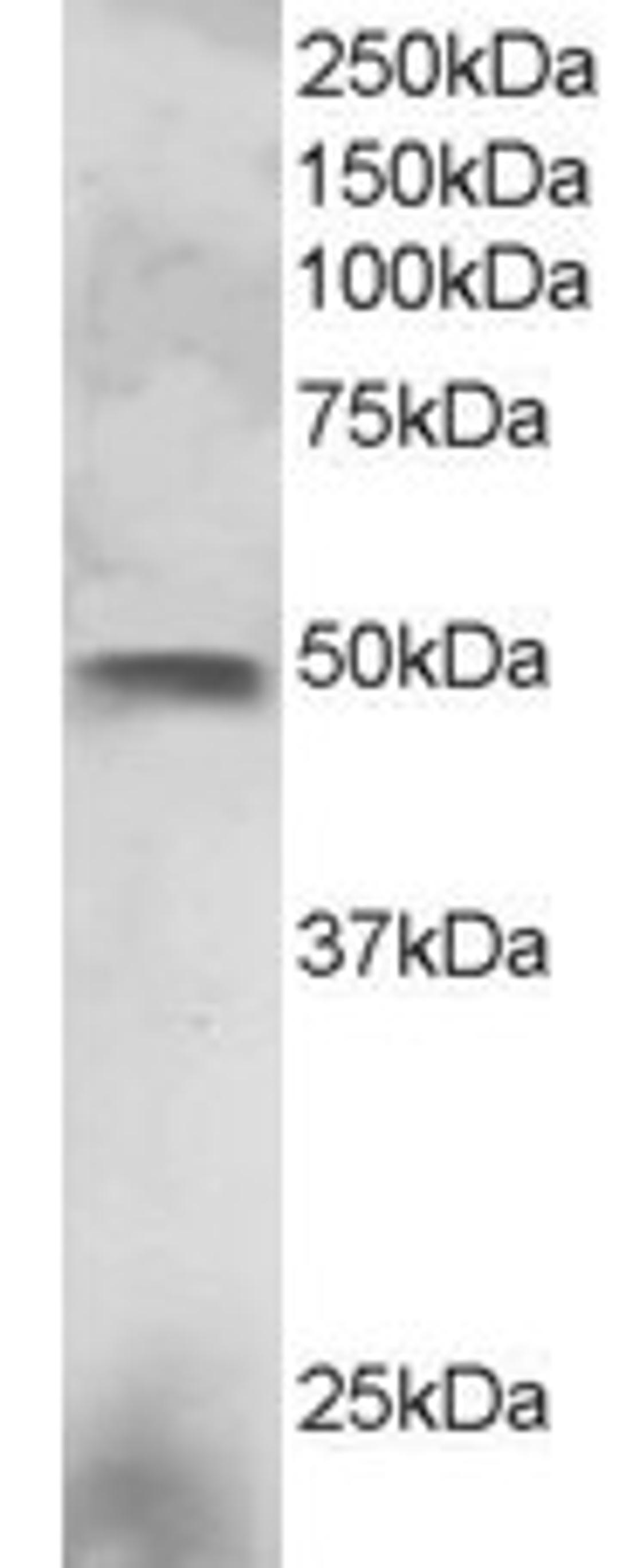 45-527 staining (3ug/ml) of NCI-H460 lysate (RIPA buffer, 30ug total protein per lane). Primary incubated for 1 hour. Detected by western blot using chemiluminescence.