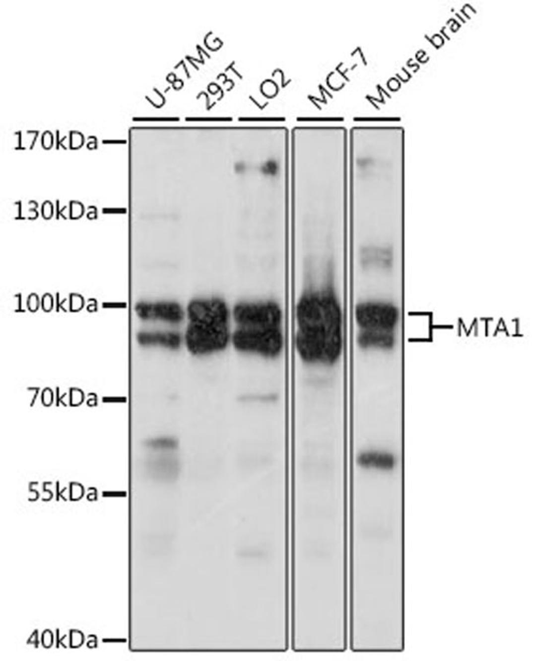 Western blot - MTA1 antibody (A16085)