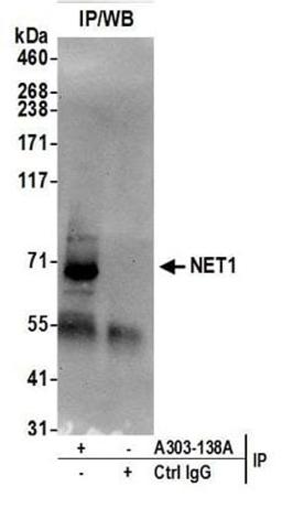 Detection of human NET1 by western blot of immunoprecipitates.