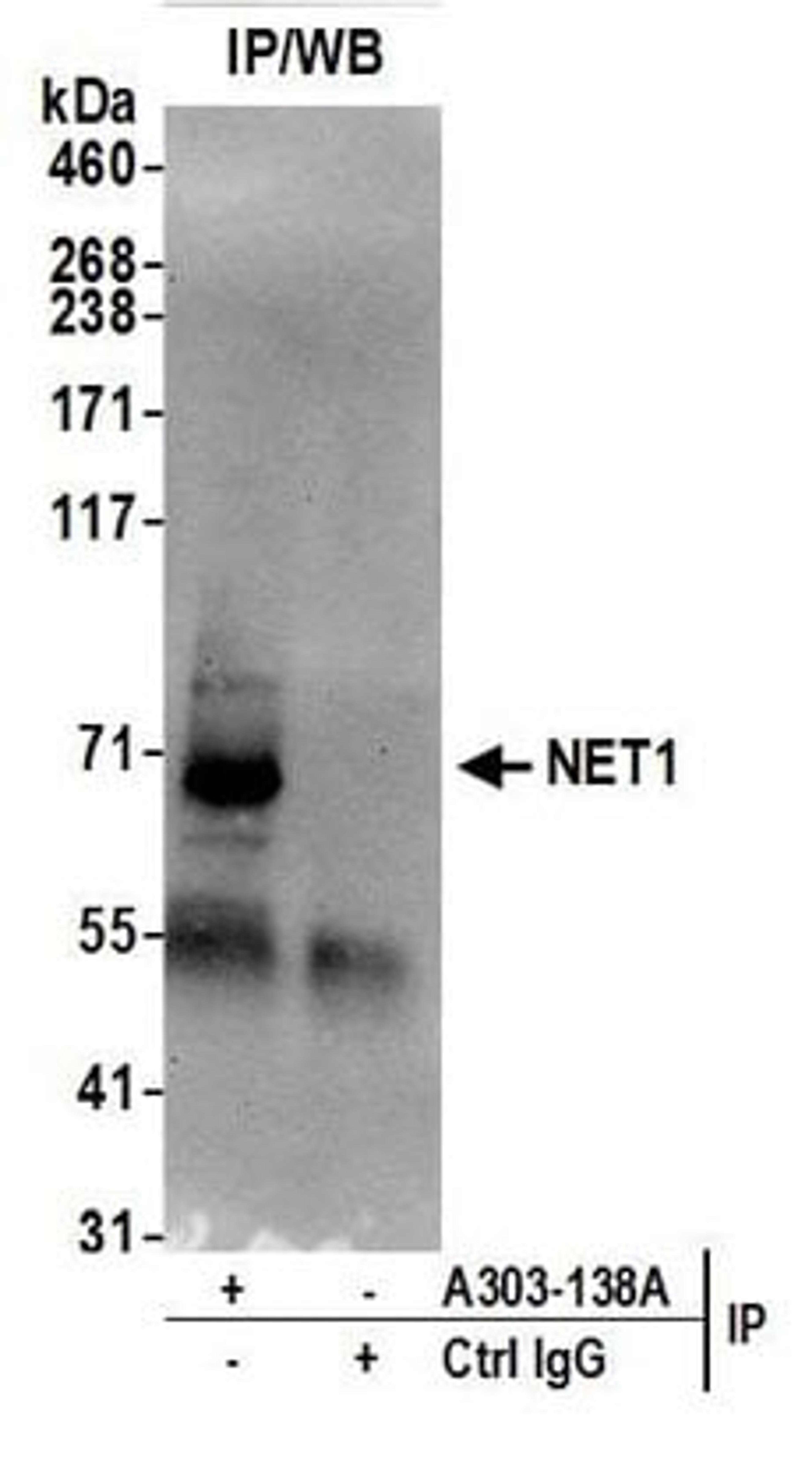 Detection of human NET1 by western blot of immunoprecipitates.