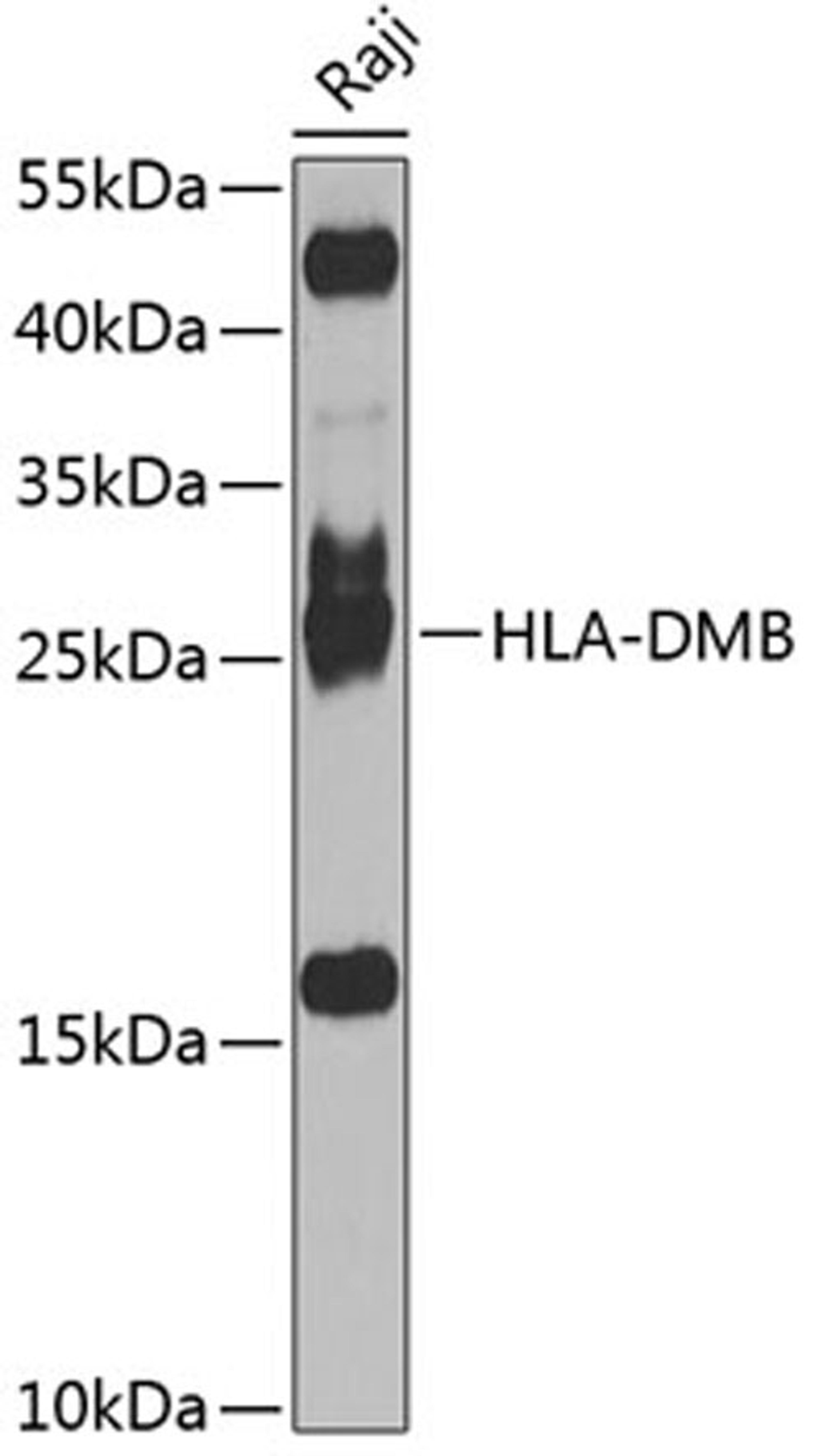 Western blot - HLA-DMB antibody (A8384)