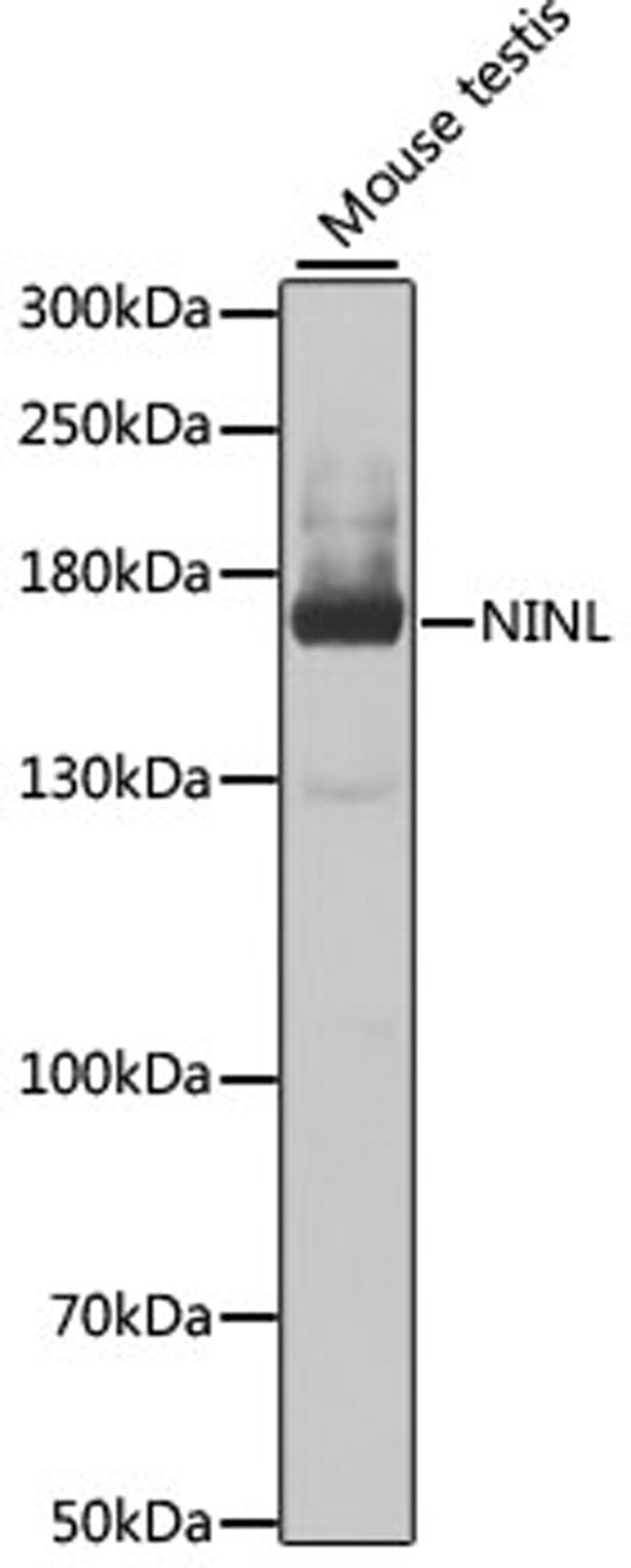 Western blot - NINL antibody (A7584)