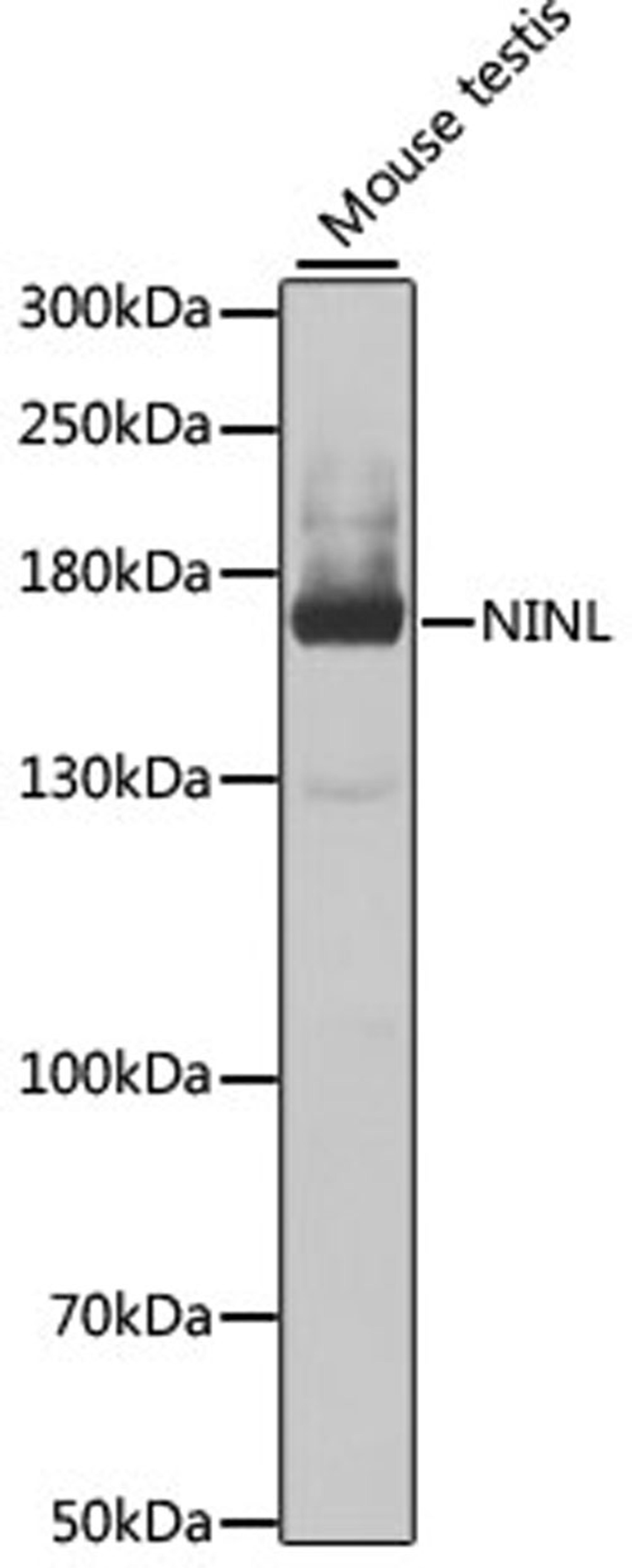 Western blot - NINL antibody (A7584)