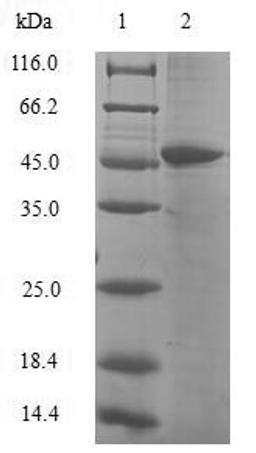 (Tris-Glycine gel) Discontinuous SDS-PAGE (reduced) with 5% enrichment gel and 15% separation gel.