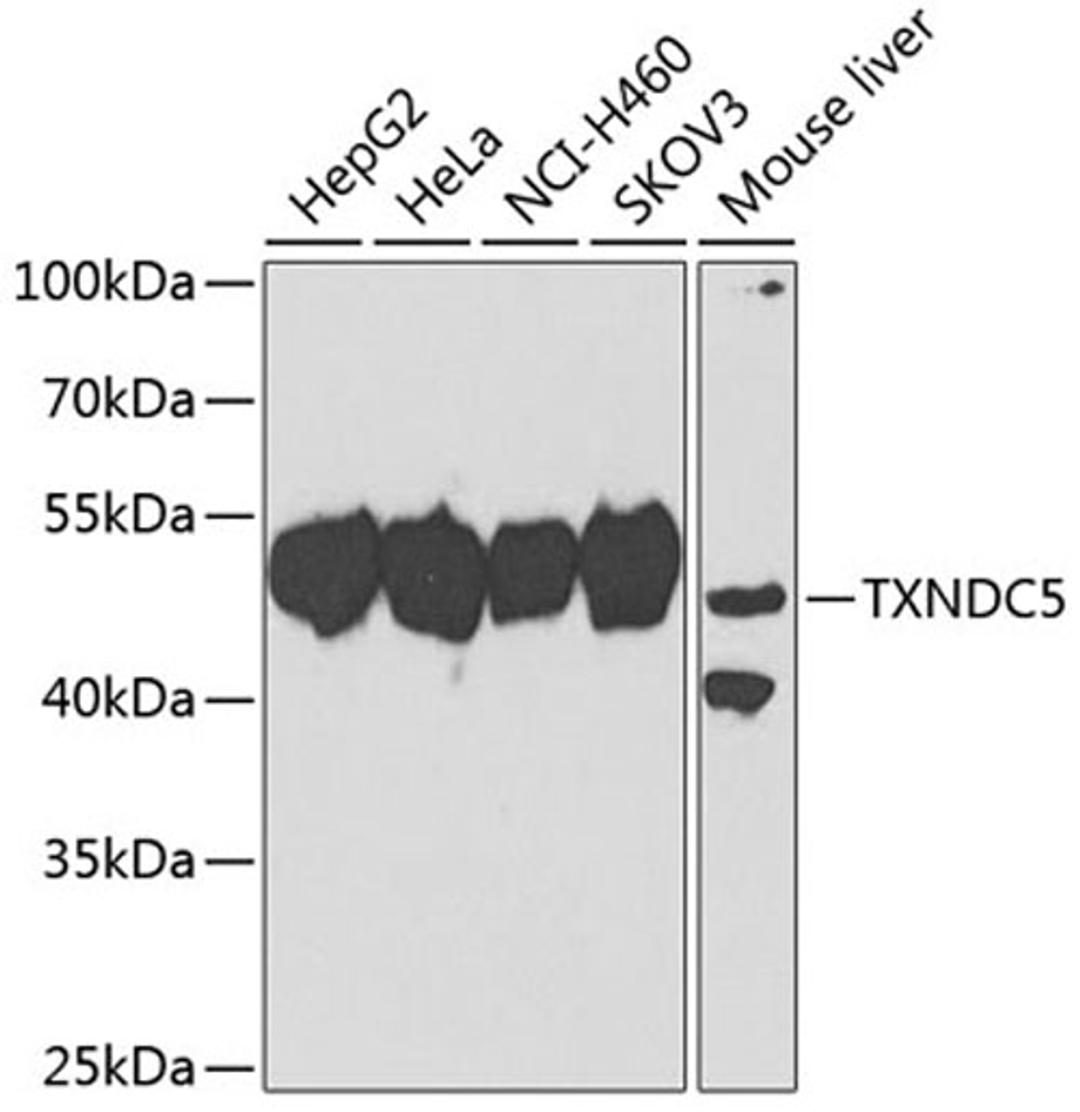 Western blot - TXNDC5 antibody (A7315)