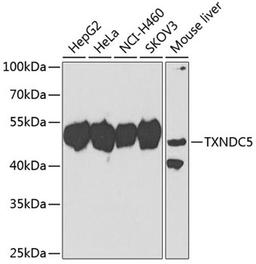 Western blot - TXNDC5 antibody (A7315)