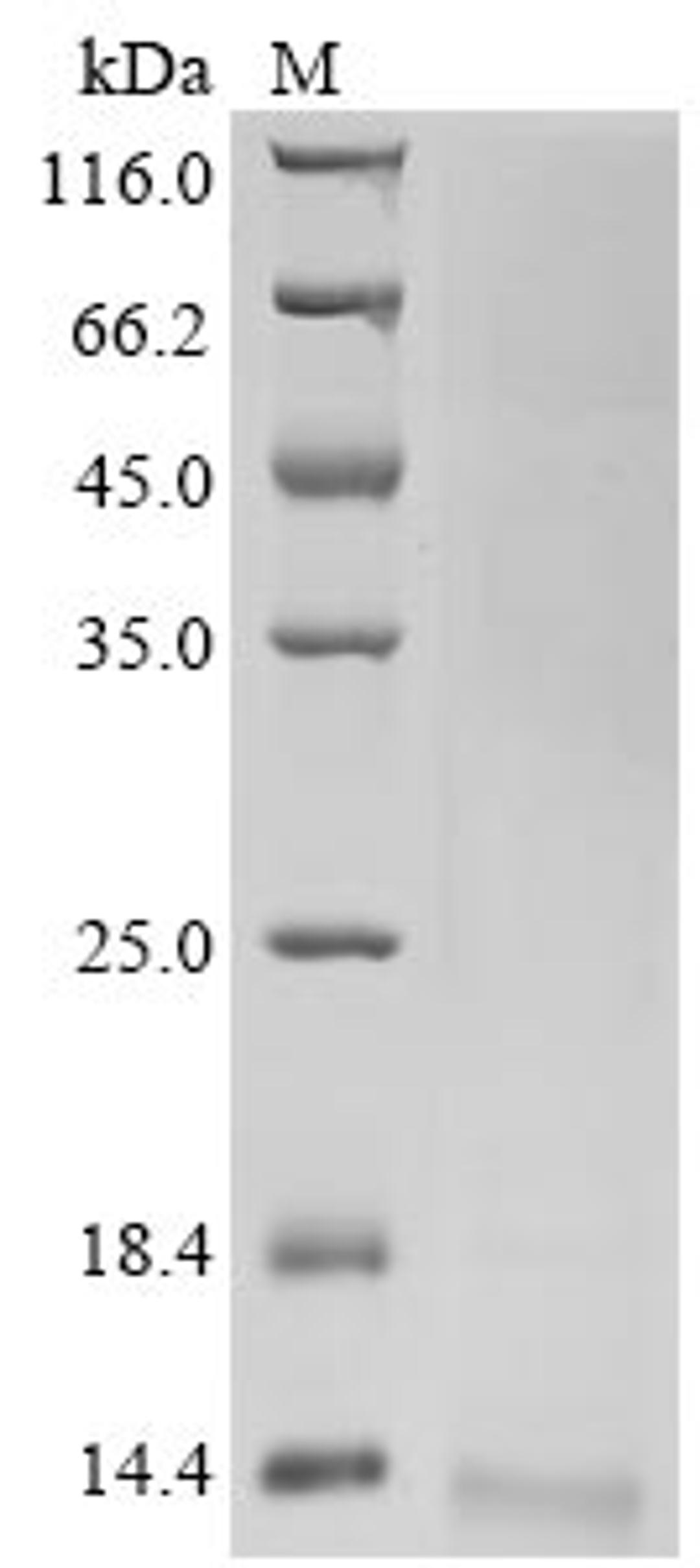 (Tris-Glycine gel) Discontinuous SDS-PAGE (reduced) with 5% enrichment gel and 15% separation gel.