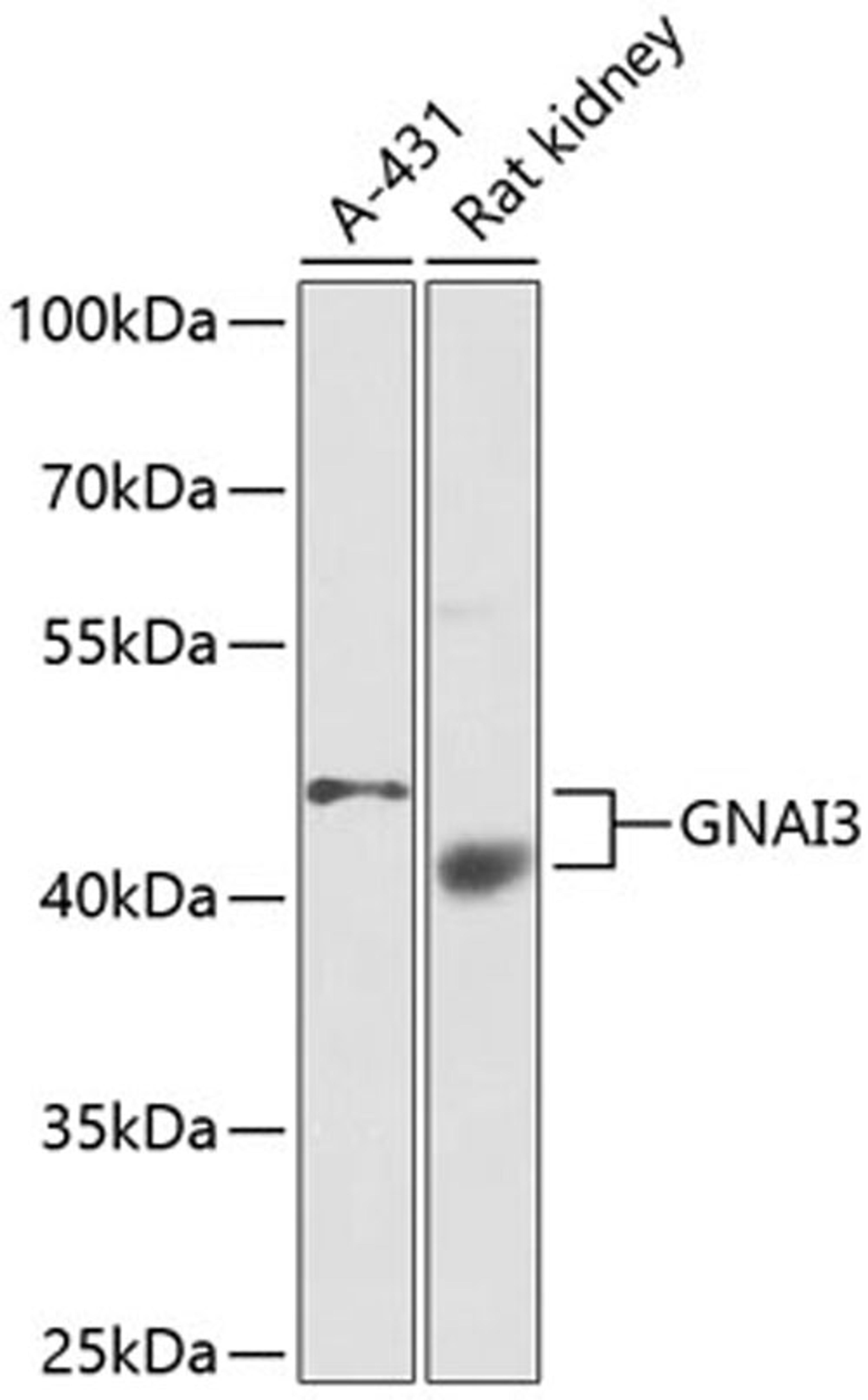 Western blot - GNAI3 antibody (A1922)