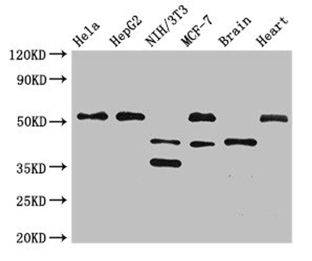 Western Blot. Positive WB detected in: Hela whole cell lysate, HepG2 whole cell lysate, NIH/3T3 whole cell lysate, MCF-7 whole cell lysate, Mouse brain tissue, Rat heart tissue. All lanes: LAX1 antibody at 2.7ug/ml. Secondary. Goat polyclonal to rabbit IgG at 1/50000 dilution. Predicted band size: 45, 36, 43 kDa. Observed band size: 51, 45, 36 kDa. 