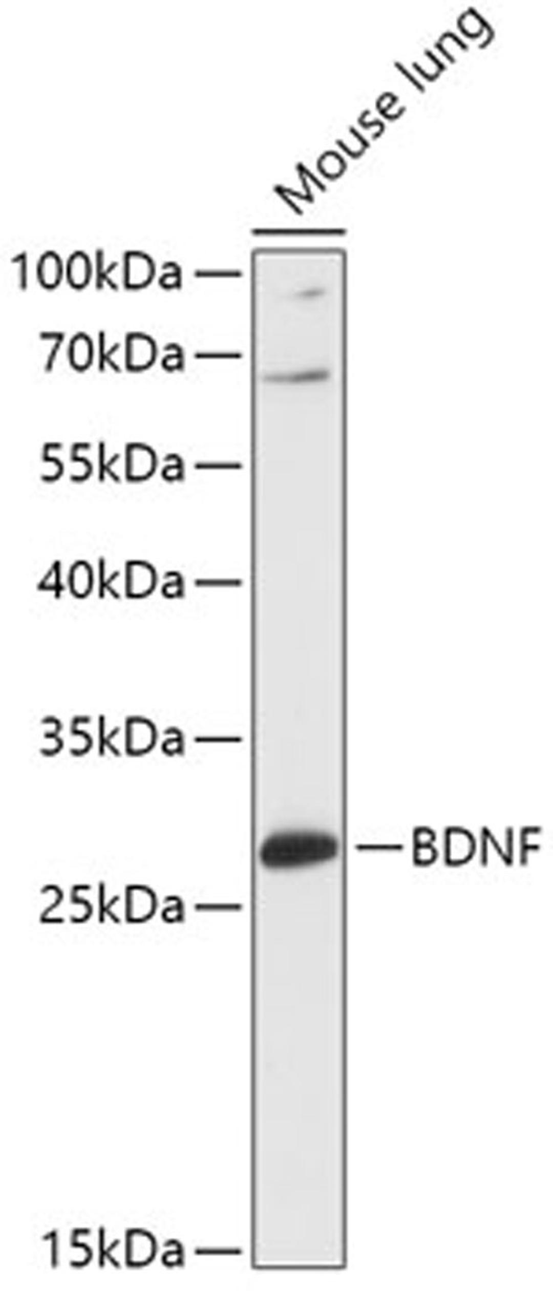 Western blot - BDNF antibody (A16299)