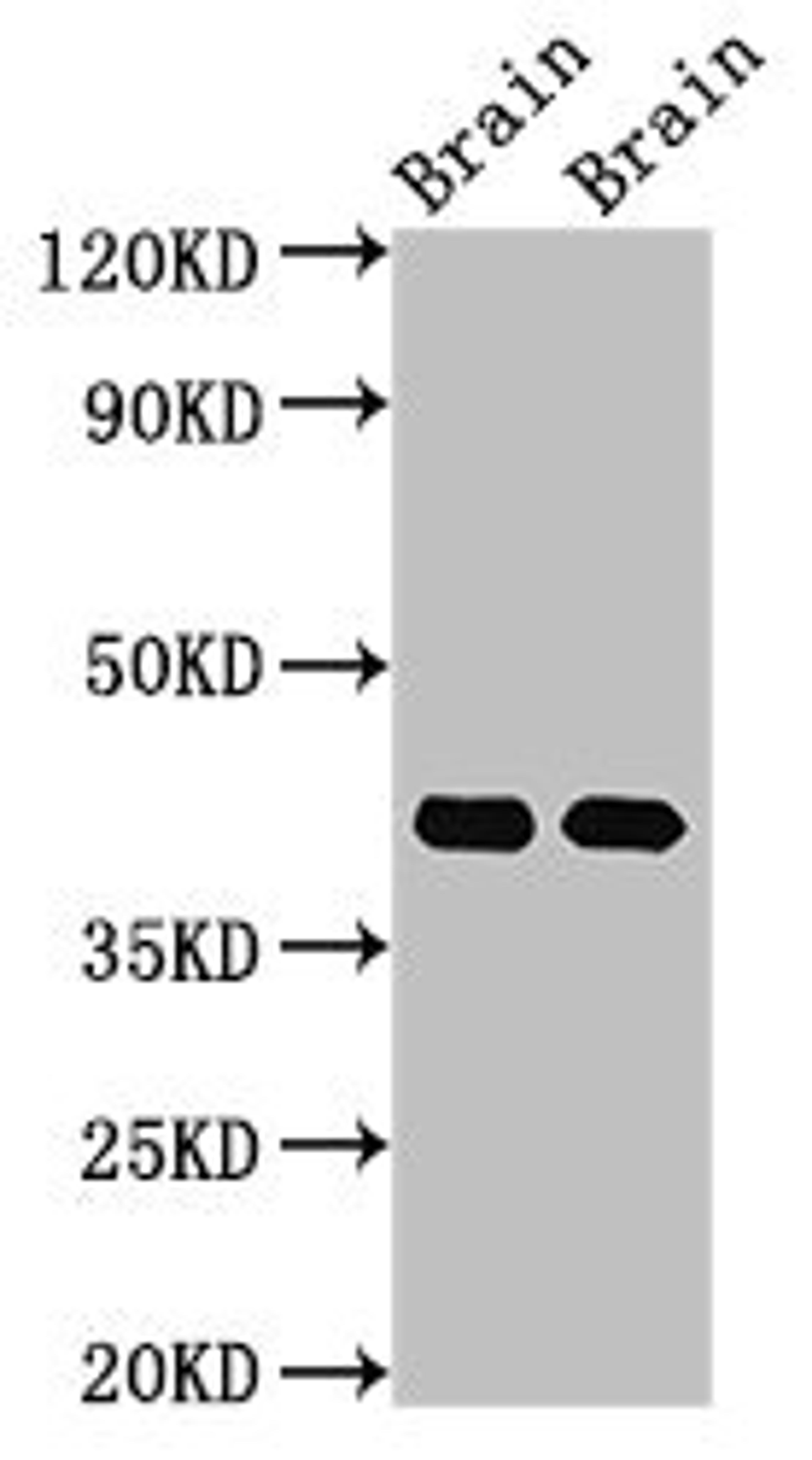 Western Blot. Positive WB detected in: Rat brain tissue, Mouse brain tissue. All lanes: Gnao1 antibody at 3µg/ml. Secondary. Goat polyclonal to rabbit IgG at 1/50000 dilution. Predicted band size: 41 kDa. Observed band size: 41 kDa