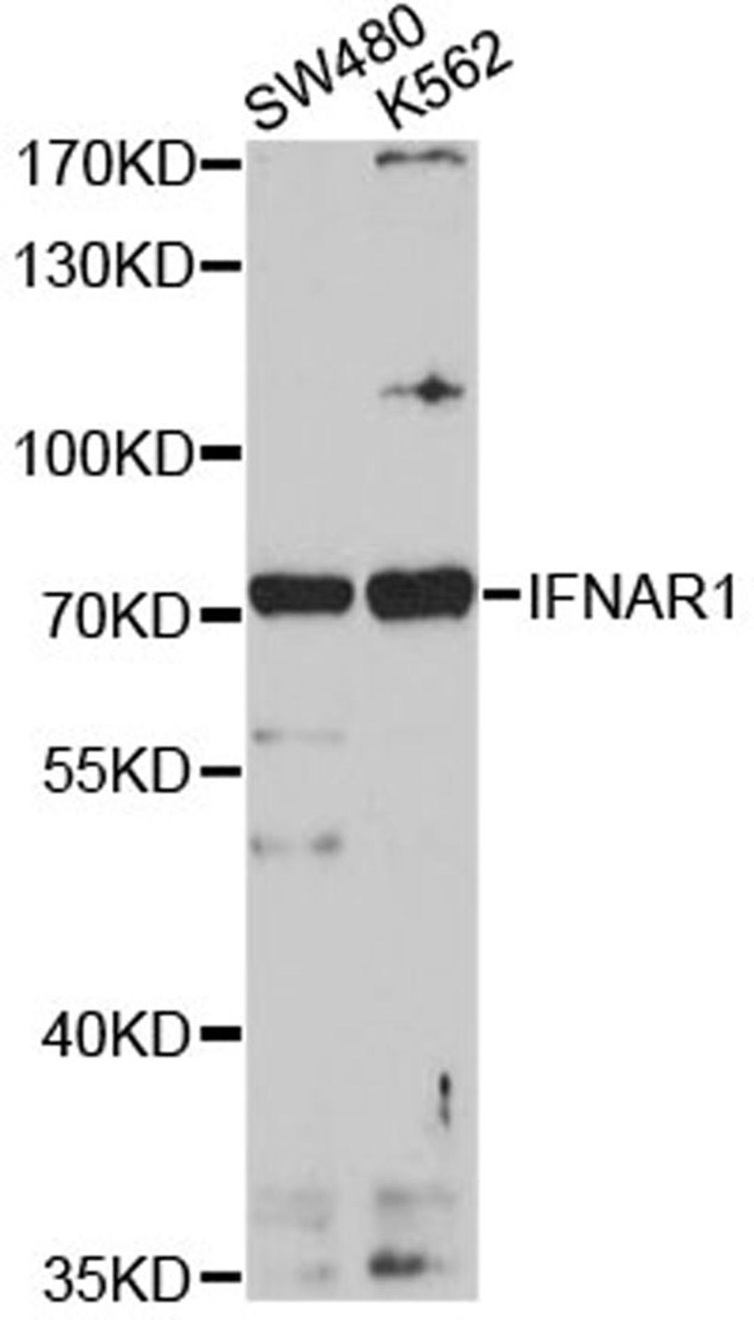 Western blot - IFNAR1 antibody (A1715)