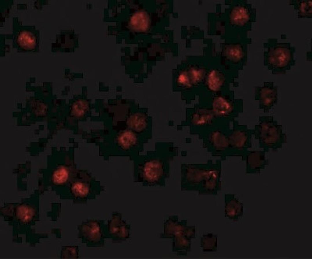 Immunofluorescence: ATP11B Antibody [NBP1-77190] - K562 cells 20 ug/mL.