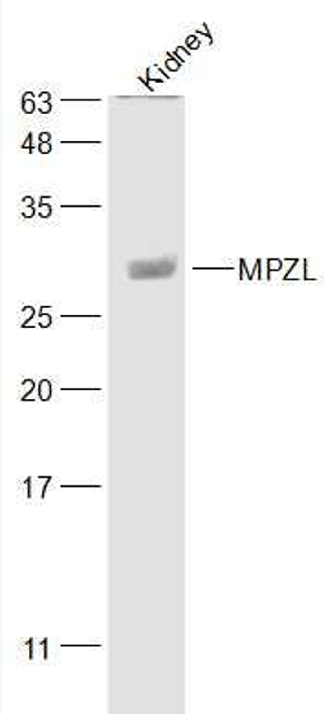 Western blot analysis of mouse kidney cell lysate using MPZL antibody