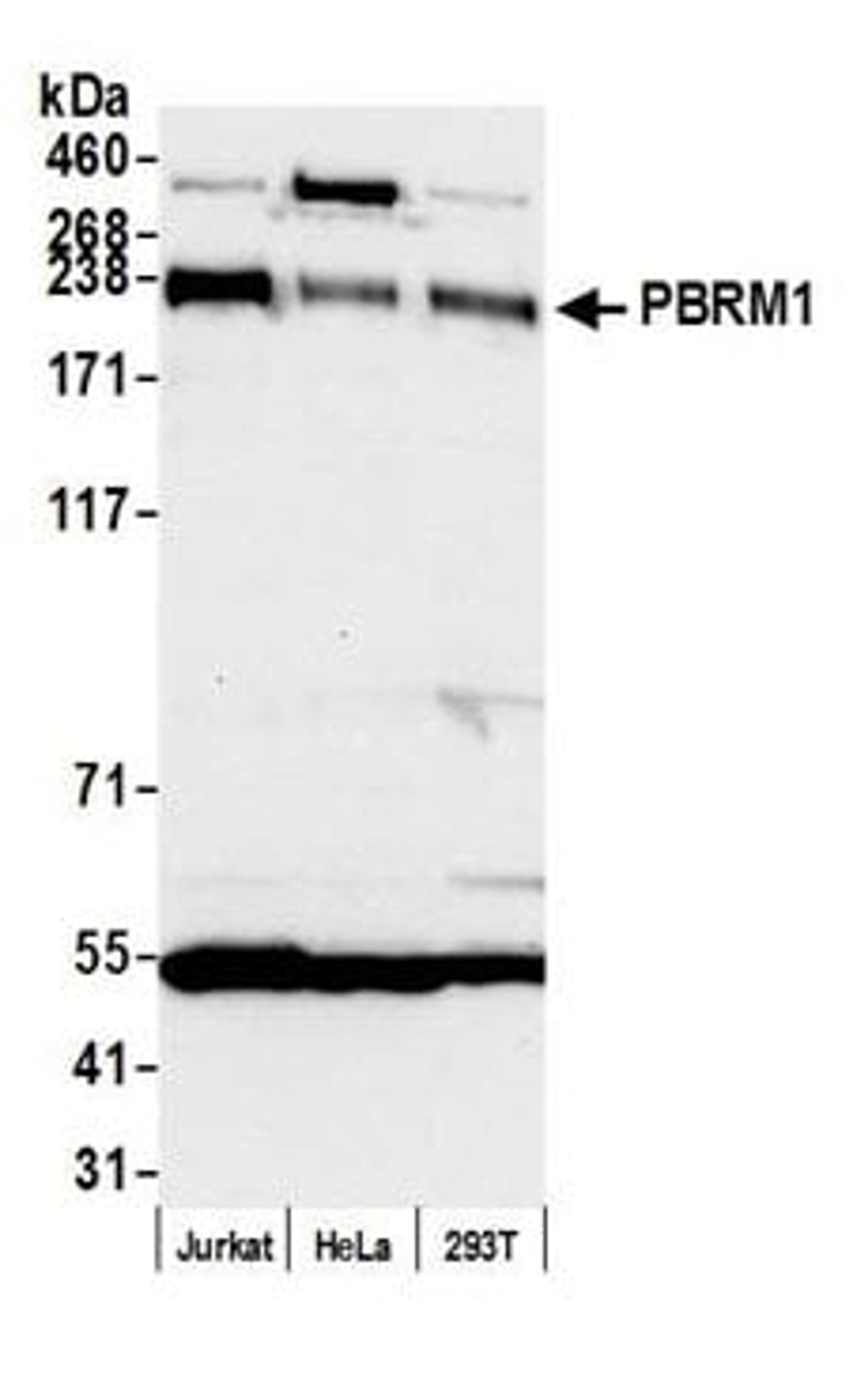 Detection of human PBRM1 by western blot.