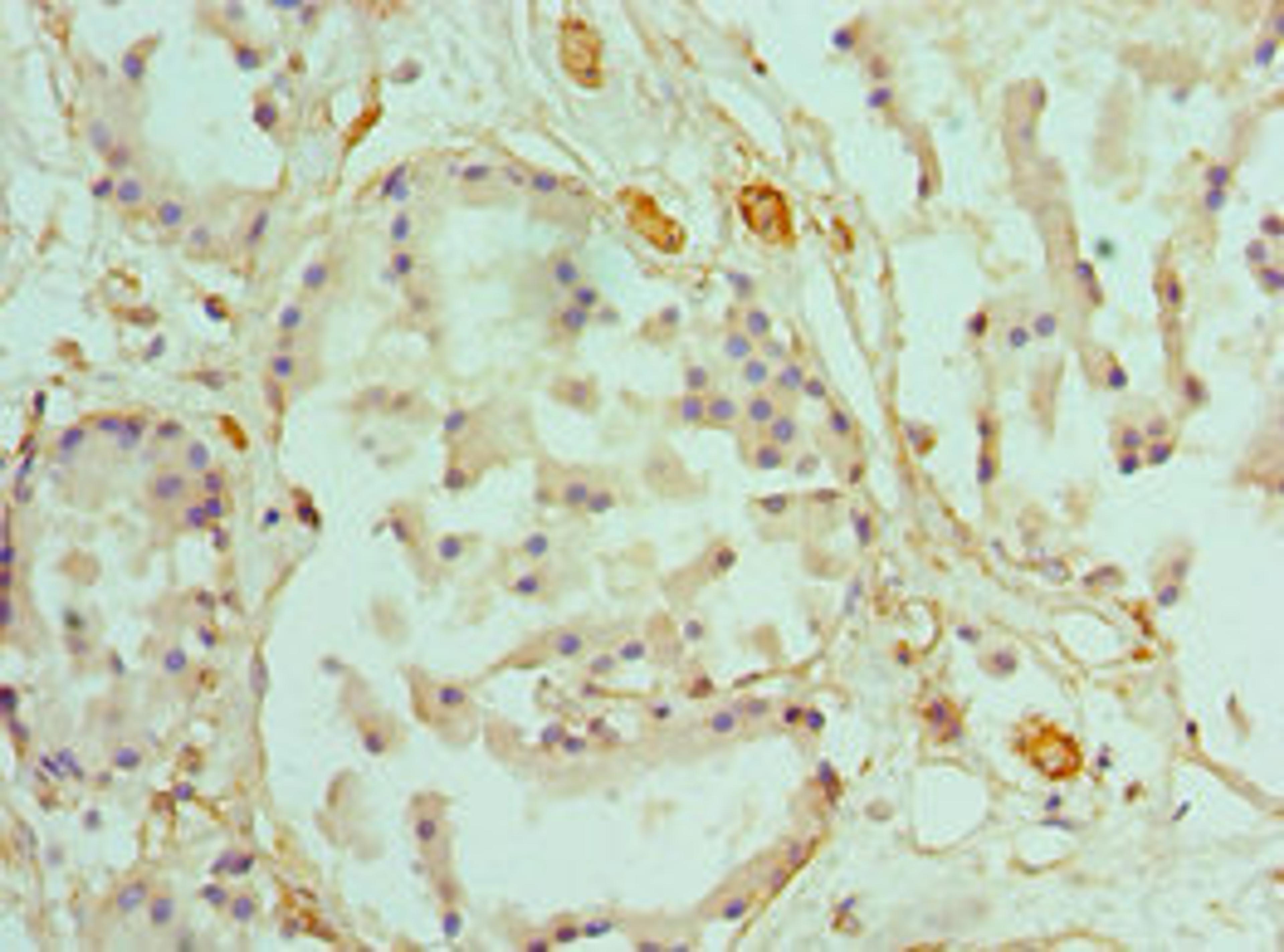 Immunohistochemistry of paraffin-embedded human prostate tissue using CSB-PA004441DSR1HU at dilution of 1:100