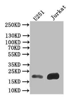 Western Blot. Positive WB detected in: U251 whole cell lysate,JK whole cell lysate. All lanes: FTH1 antibody at 1:500. Secondary. Goat polyclonal to mouse IgG at 1/50000 dilution. Predicted band size: 22 kDa. Observed band size: 22 kDa.