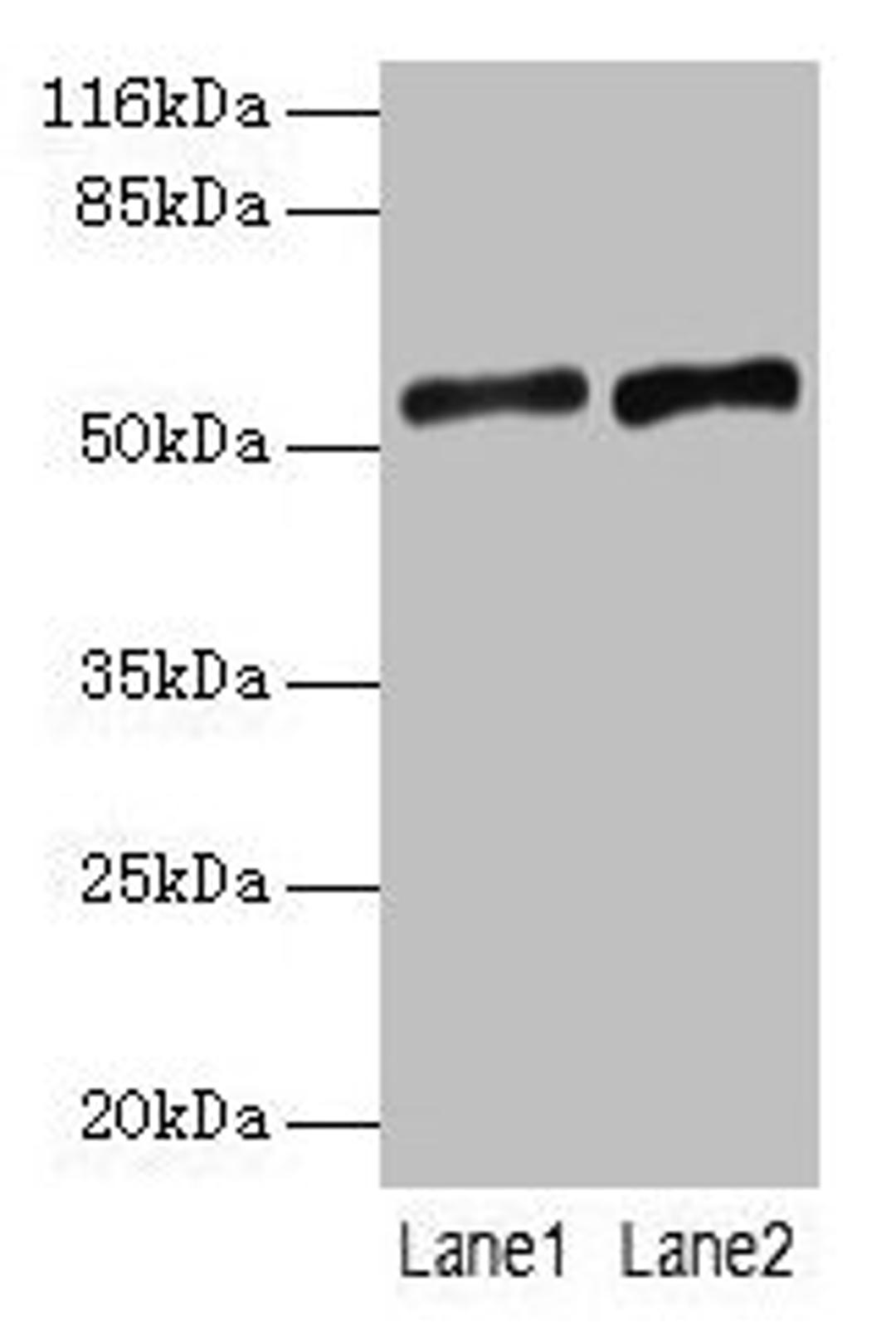 Western blot. All lanes: SLC2A4 antibody at 2µg/ml. Lane 1: Mouse heart tissue. Lane 2: Hela whole cell lysate. Secondary. Goat polyclonal to rabbit IgG at 1/10000 dilution. Predicted band size: 55, 44 kDa. Observed band size: 55 kDa