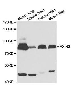 Western blot analysis of extracts of various cell lines using AXIN2 antibody