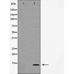 Western blot analysis of Hela cell lysate using Synuclein beta antibody